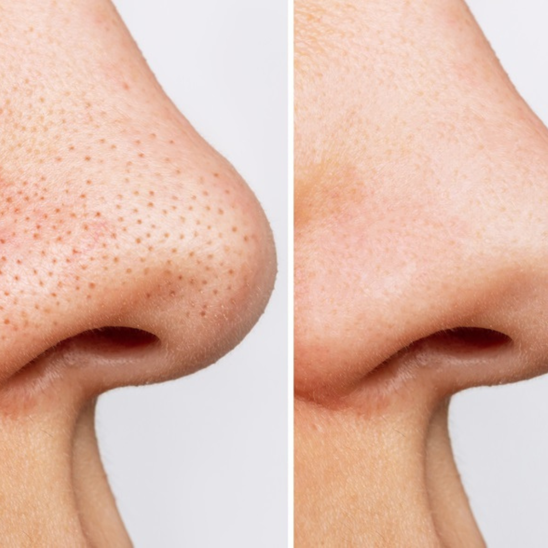 Anua Heartleaf Pore Control Cleansing Oil